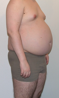 fetter Bauch