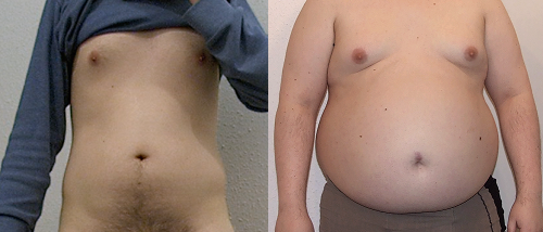 before and after my weight gain