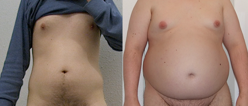 before and after my weight gain