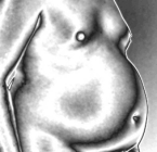 Fettbauch