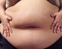 fetter Bauch