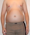 bauch18