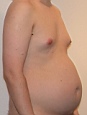 bauch17