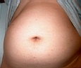 bauch1