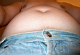 bauch2