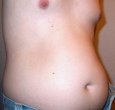 bauch4