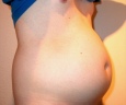 bauch5