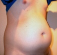 bauch6