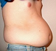 bauch7