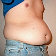 bauch8