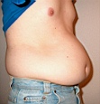 bauch9