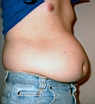 bauch13