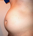 bauch10