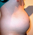 bauch11