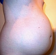 bauch14