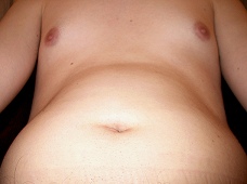mein dicker Bauch
